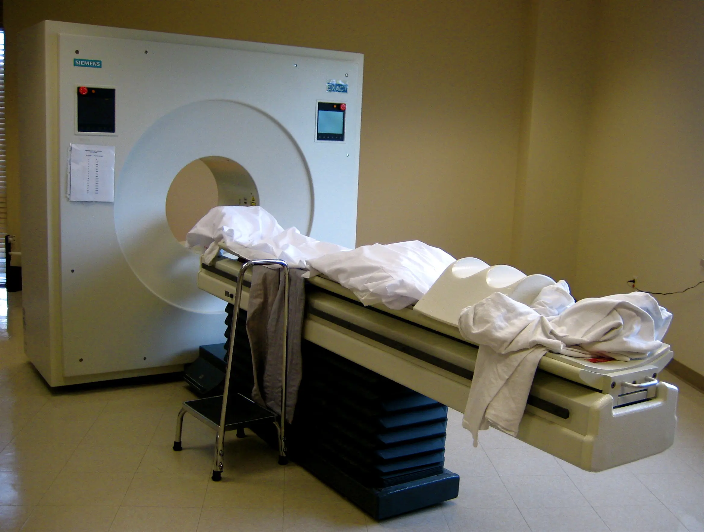 PET brain scan showing amyloid buildup