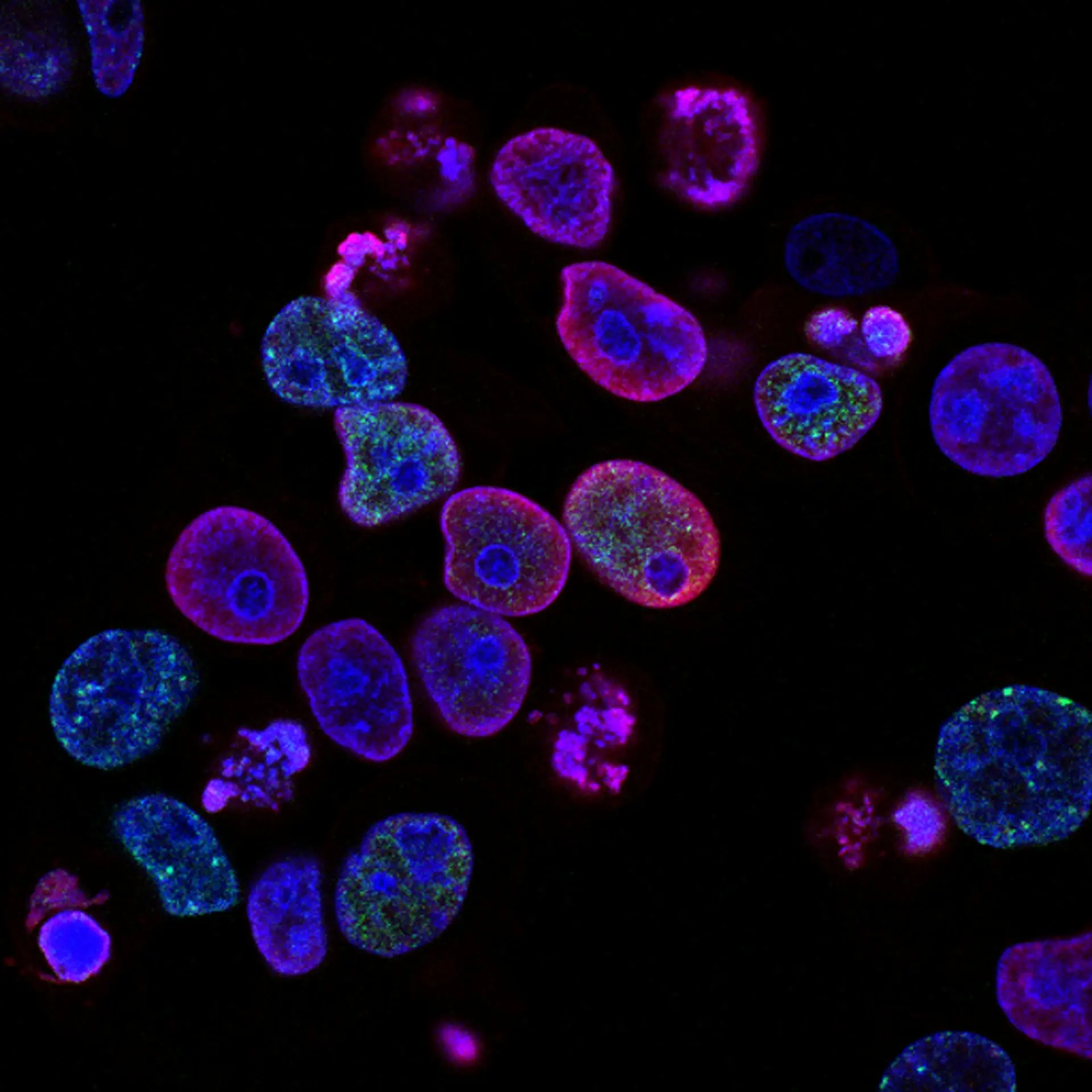 Neural protein aggregation under microscope